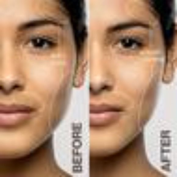 Dermaflash LUXE+ Advanced Sonic Dermaplaning & Peach Fuzz Removal Set - Picture 2 of 5